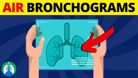 Air Bronchogram (Medical Definition) | Quick Overview