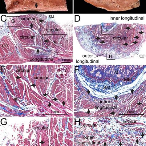 Histological examinations of the pyloric sphincter (PS) with the ...