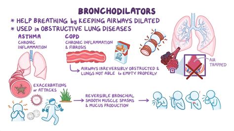 Bronchodilators: Nursing pharmacology - Osmosis Video Library