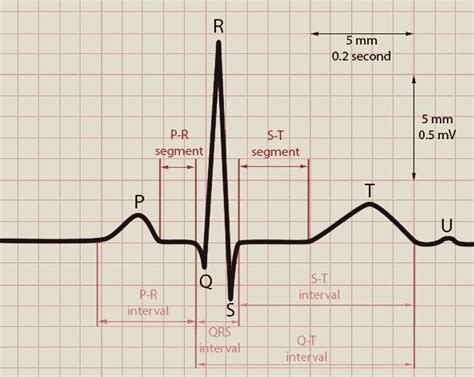 Normal Ecg Labeled Normal ecg tracings comprise | Cardiology, Pr ...