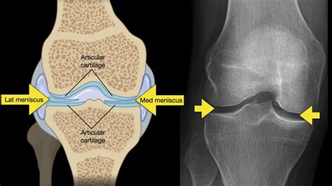 Awesome What Are The 3 Views Of A Knee X Ray Current Issues In Accounting