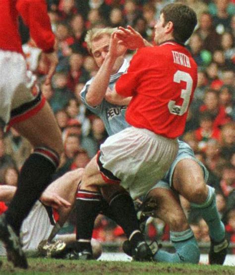 David Busst injury (Graphic image) | RedCafe.net