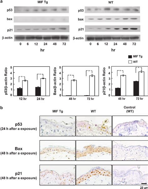 p53, bax and p21 protein expression in UV-irradiated MIF Tg and WT mice... | Download Scientific ...