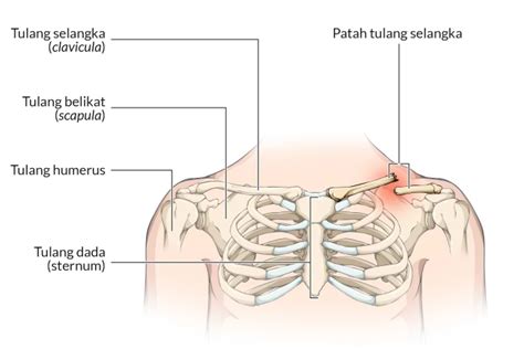 Patah Tulang Disebut Juga – Materi Belajar Online