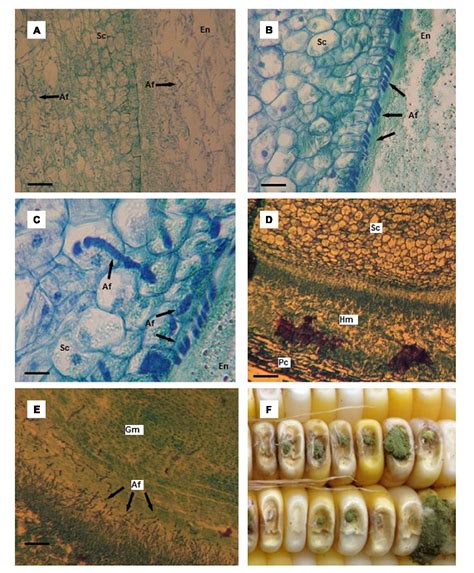 Figure 2 from A Histological Study of Aspergillus flavus Colonization ...