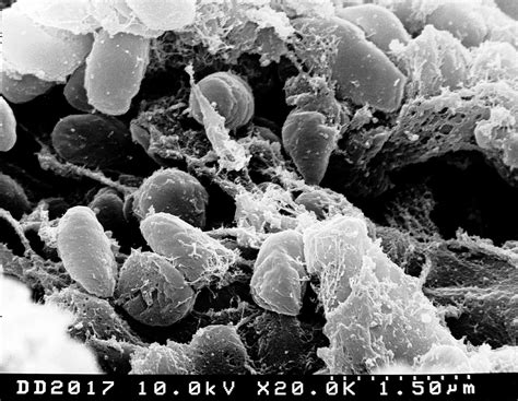 Download free photo of Pestis,bacteria,bubonic plague,electron ...