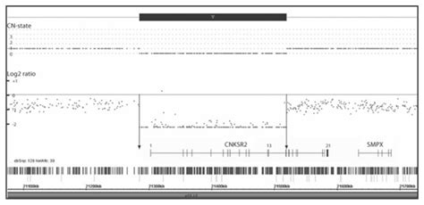 The Affymetrix SNP-array result of the patient. An Xp22.12 deletion... | Download Scientific Diagram