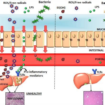 Gut–liver axis components in normal conditions (right part) and in ...