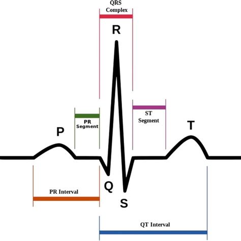 Components of an ECG beat, source: [9]. | Download Scientific Diagram