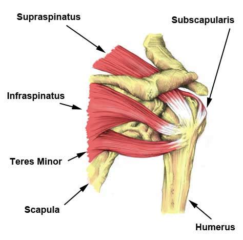 Supraspinatus Scheur - Symptomen, Oorzaken, Behandeling & Revalidatie ...