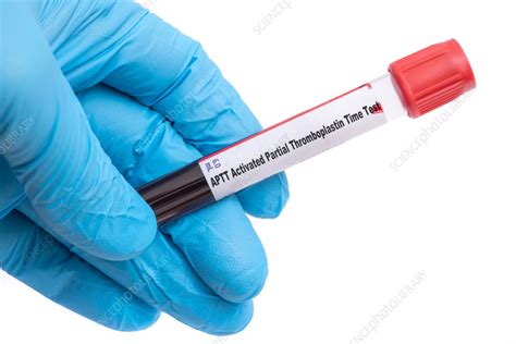 Activated partial thromboplastin time test, conceptual image - Stock Image - F037/0379 - Science ...