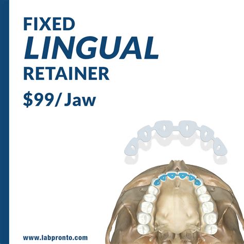 NEW Service Fixed Lingual Retainer Now Available on LabPronto.com!