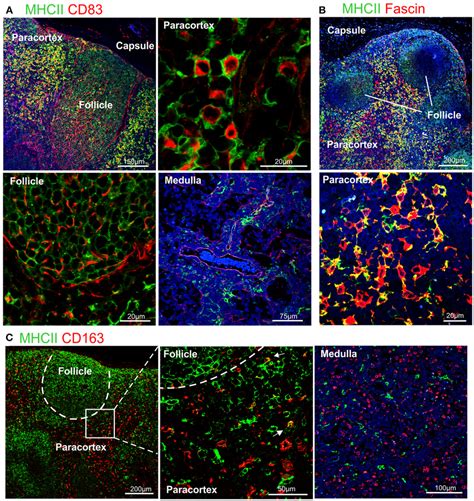 | Differential expression of MHC II in dendritic cells and macrophages ...