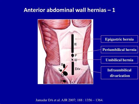 Ultrasound of the abdominal wall hernias