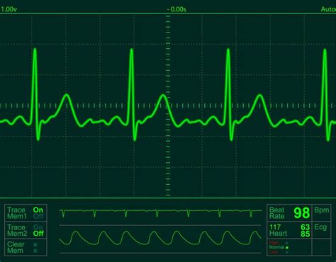 ECG con Theremino | PhysicsOpenLab