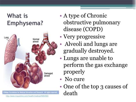 PPT - Emphysema PowerPoint Presentation, free download - ID:6145394