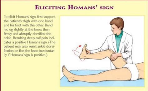 Homans' sign, signs of deep vein thrombosis. | Homans sign, Nursing information, Nurse