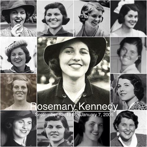 Rosemary Kennedy Lobotomy Before And After Pictures