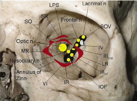 Anatomy of the left orbital apex, highlighting the extraocular muscle... | Download Scientific ...