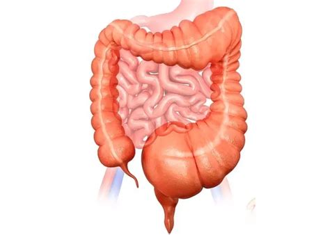 Most Common Complications & Side Effects of Ulcerative Colitis ...