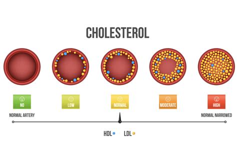 Statin History