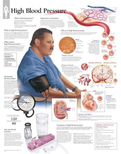 High Blood Pressure | Scientific Publishing