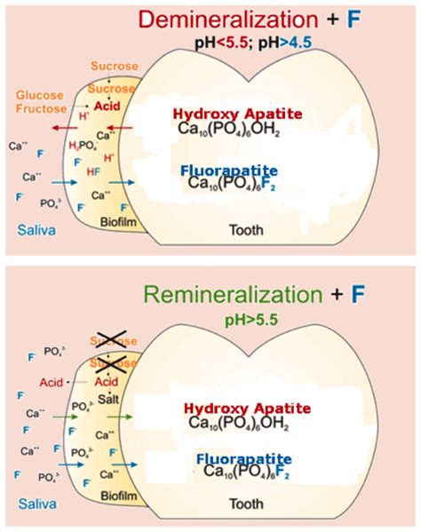 Arginine can help prevent tooth decay - AdVance Dental PC | Dentist Birmingham AL