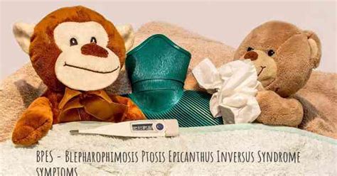 Blepharophimosis Ptosis Epicanthus Inversus Syndrome Or Bpes