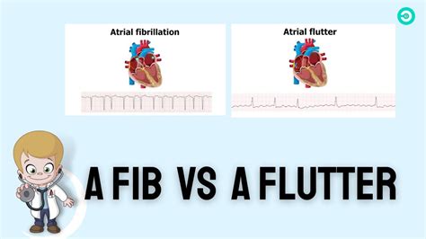 Atrial Fibrillation (aFib) Vs Atrial Flutter (aFlutter): ECG Review - YouTube