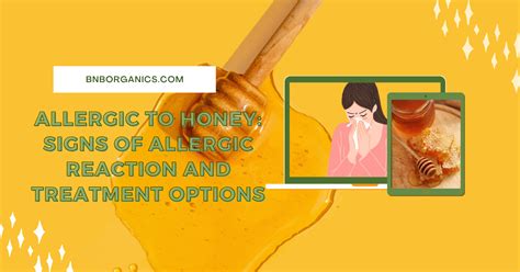 Allergic to Honey: Signs of Allergic Reaction and Treatment Options – B ...