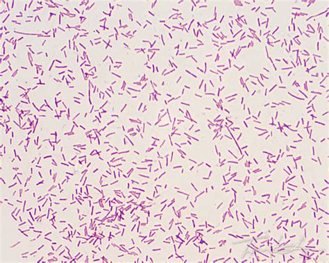 Gram Stain E Coli