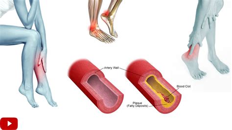 Fun Info About How To Increase Leg Circulation - Makepanic42