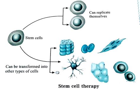 Draw well labelled diagram of Stem cell therapy: