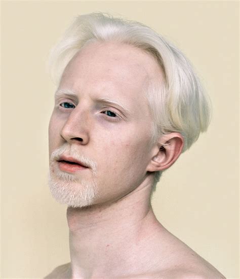 58 Albino People Who'll Mesmerize You With Their Otherworldly Beauty | Bored Panda