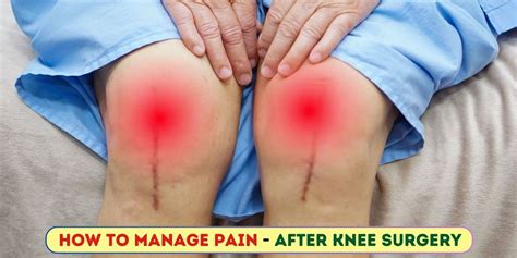 How to Manage Pain After Knee Replacement Surgery? - DR. MURTAZA ADEEB
