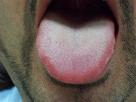 Look at your tongue, check your health