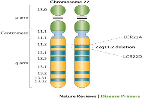 Genetics – 22 q