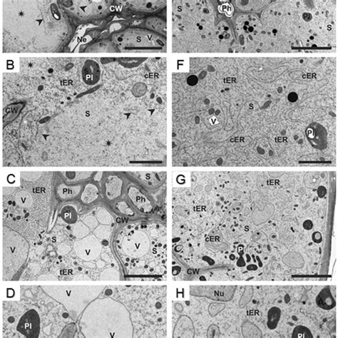 Anatomy of nematode-induced syncytia. Light microscopy images of cross ...