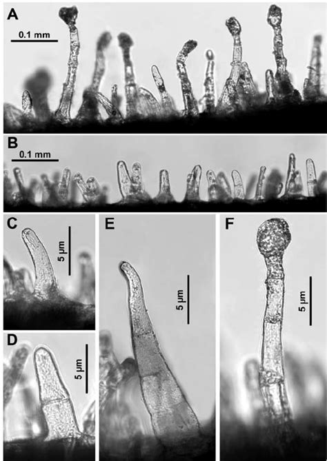 Figure 1. Light microscope images showing different trichomes within... | Microscopic images ...