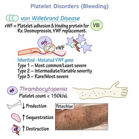 Pathology Glossary: Platelet Disorders | Draw It to Know It