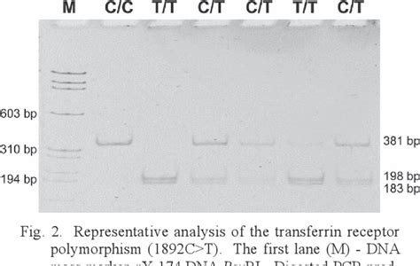 Figure 1 from The A Allele of the -576G>A polymorphism of the transferrin gene is associated ...