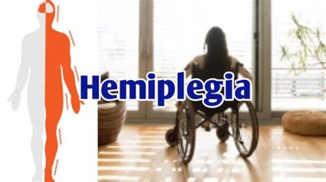 Hemiplegia – Types, Causes, Symptoms and Treatment | Healthtian