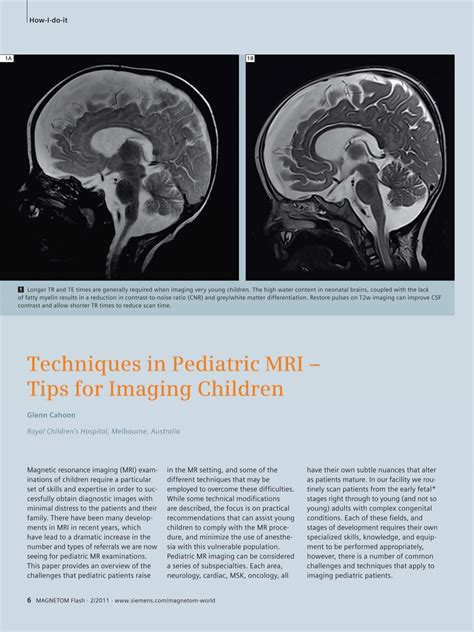 Techniques in Pediatric MRI – Tips for Imaging Children - Siemens ...