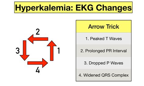 Hyperkalemia Ekg