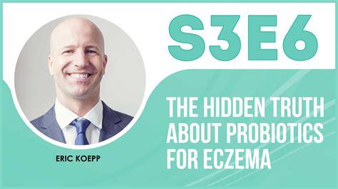 The Hidden Truth About Probiotics For Eczema – The Eczema Podcast S3E6 ...