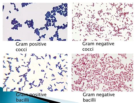 Gram positive bacilli antibiotic