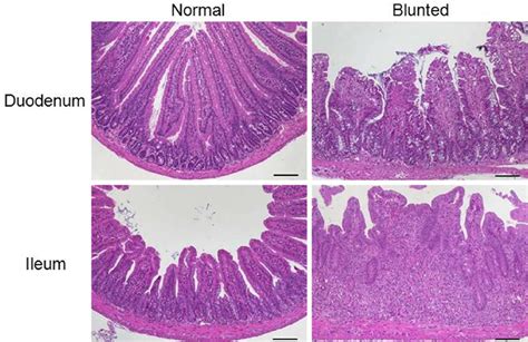 Representative H&E-stained sections of the small intestine illustrate... | Download Scientific ...