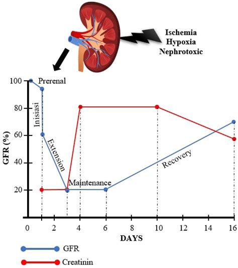 The relationship between GFR and serum creatinine (SCr) in the AKI... | Download Scientific Diagram