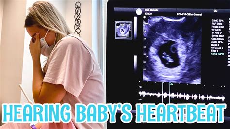 Dating Scan 7 Weeks Heartbeat – Telegraph