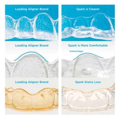 Invisalign alternative – Spark Clear Aligners